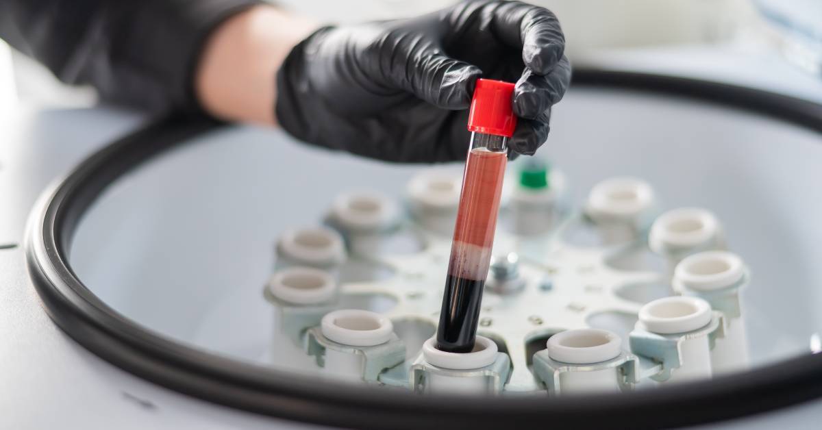 A close-up of a hand wearing a black latex glove holding a sample tube with a red cap. Inside the tube are separated liquids.